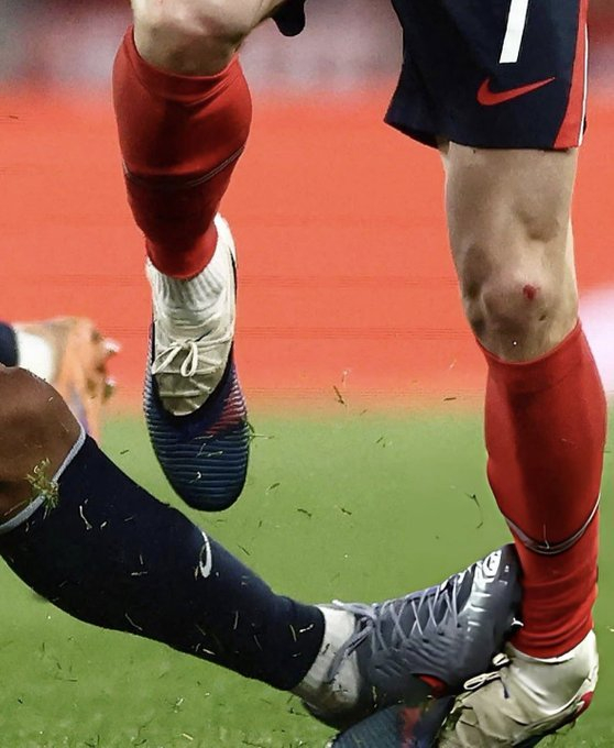 福登遭阿劳霍凶狠铲球被换下引争议